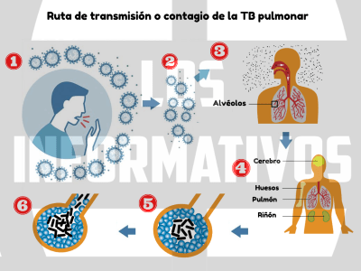 Explicamos la ruta de transmisión de los agentes causantes de enfermedades respiratorias y la TB Elaboramos un modelo, esquema, dibujo u otro de la ruta de transmisión o contagio de los agentes causantes de enfermedades respiratorias y la TB pulmonar en nuestra comunidad.